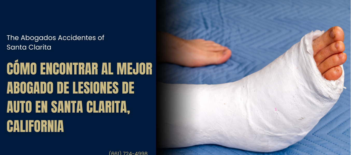 Cómo encontrar al mejor abogado de lesiones de auto en Santa Clarita, California